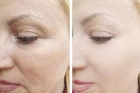 Moisturizer Before or After Retinol Best Application Tips – Mokko Beauty