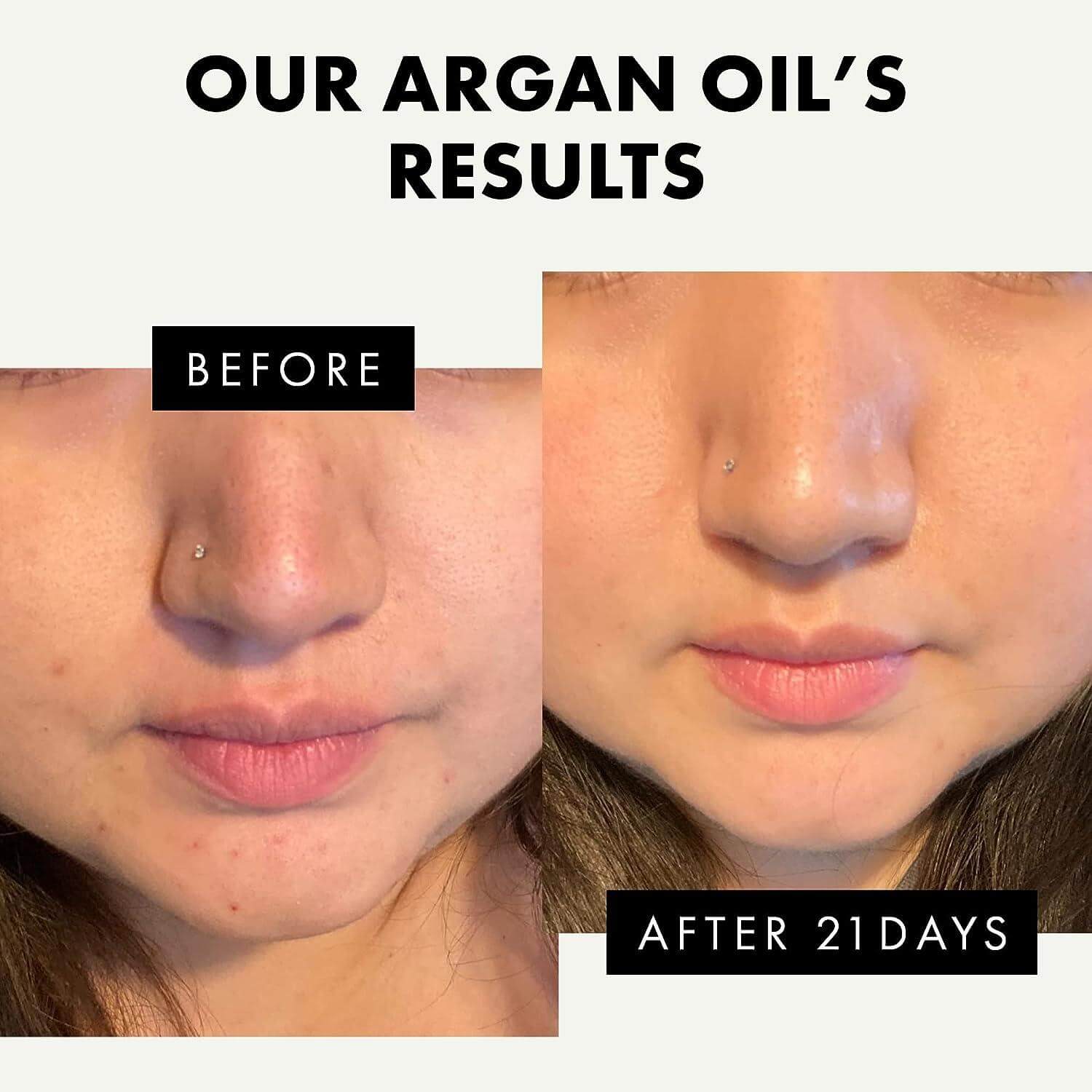 benefits of argan face oil for glowing skin