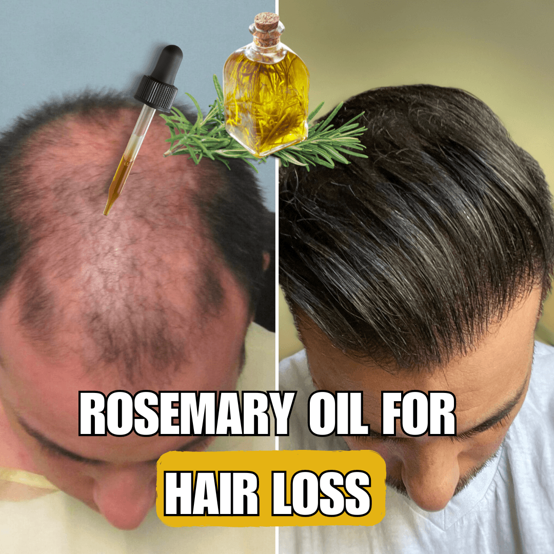 Pure rosemary oil for healthy hair growth and scalp care