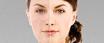 Best Face Oil for Your Skin Type in USA