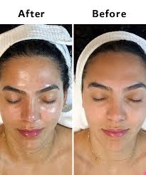 Rose water natural facial cleanser by Mokko for sensitive skin